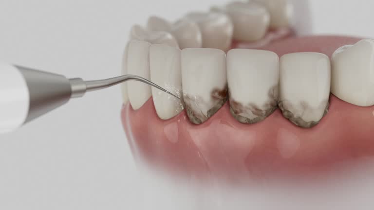 Reliable Dental Crowns And Bridges contractor in Webster County County, GA by Dentist Open Now